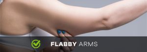 flabby arms