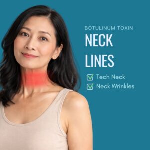 Neck lines