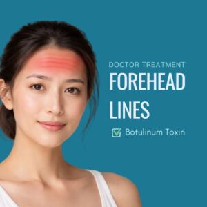 Botox forehead lines