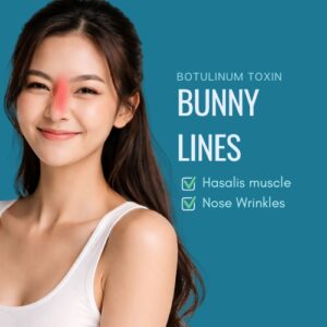 Botox bunny lines