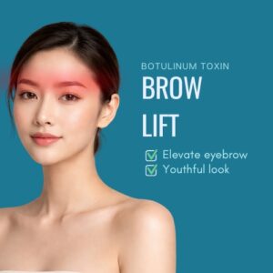 Brow lift