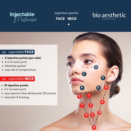 profhilo injection points