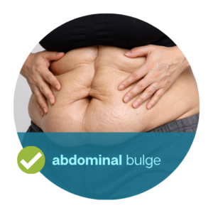 Diastasis recti treatment for abdominal bulging or pooch appearance