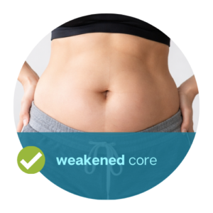 Diastasis recti treatment for weakened core support