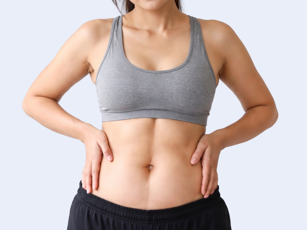 Diastasis Recti Treatment