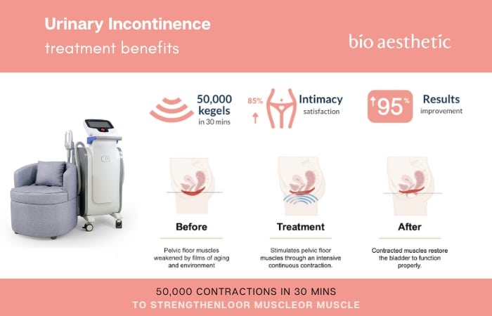 Non-Surgical Pelvic Floor Strengthening