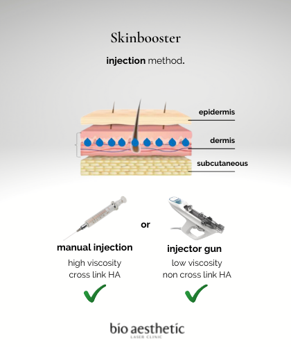 how is skinbooster injected?