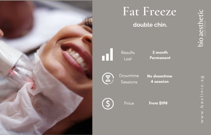 fat freeze double chin