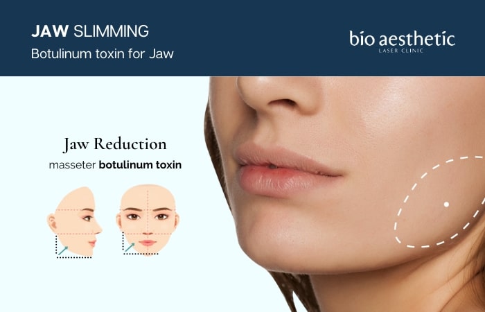 jaw botox singapore