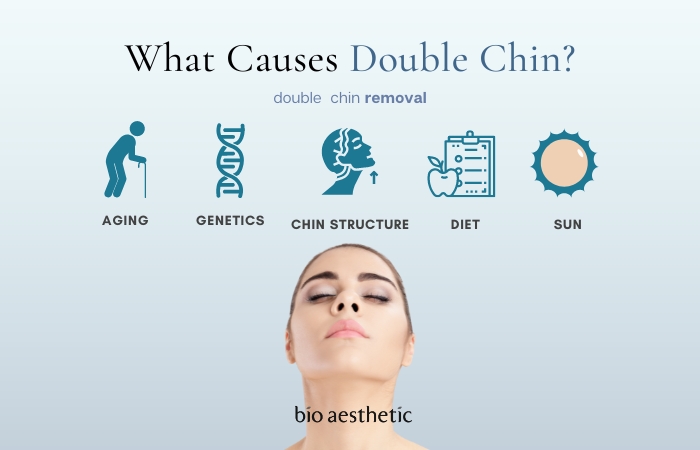 what causes double chin