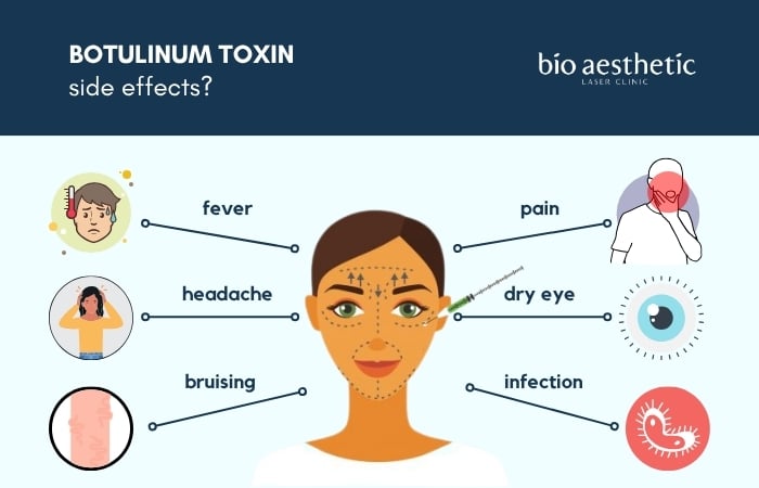 DOES BOTULINUM TOXIN HAVE SIDE EFFECTS?