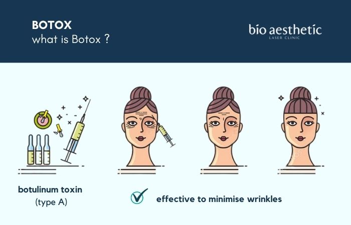 what is botox