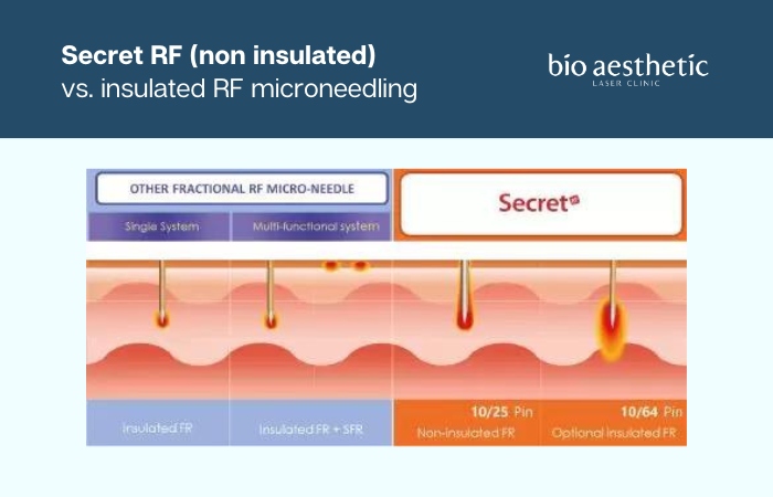 microneedling rf vs fraxel vs secret rf
