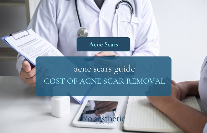 cost of acne scar treatments