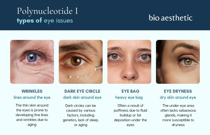common eye skin issues rejuran