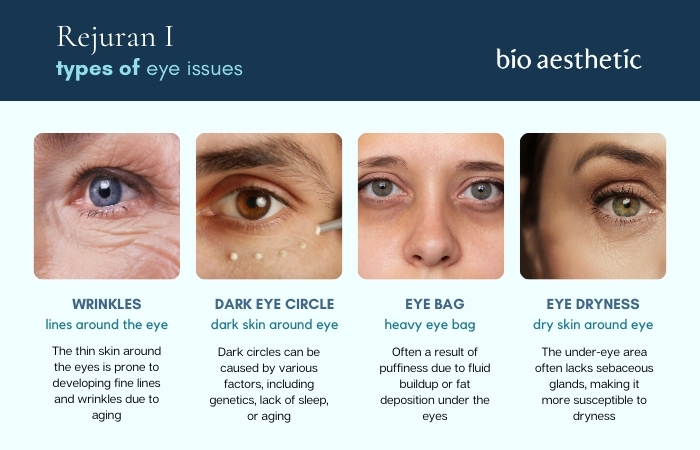 common eye skin issues