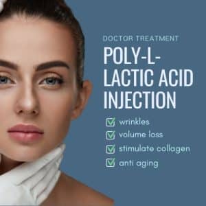 sculptra face