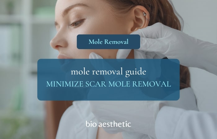 How to Minimise Scars After Mole Removal in Singapore