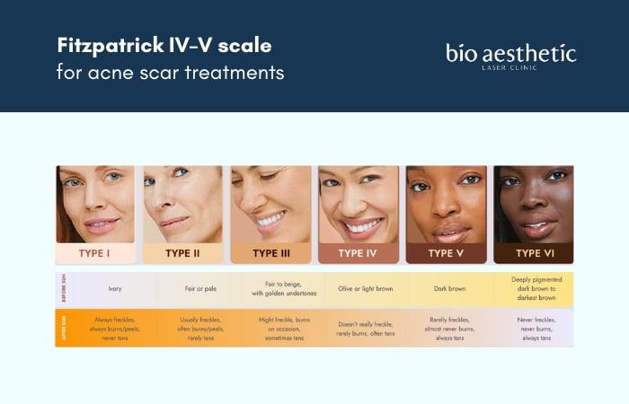 Fitzpatrick IV–V scale