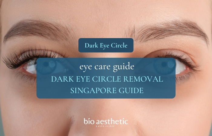 dark eye removal singapore treatments