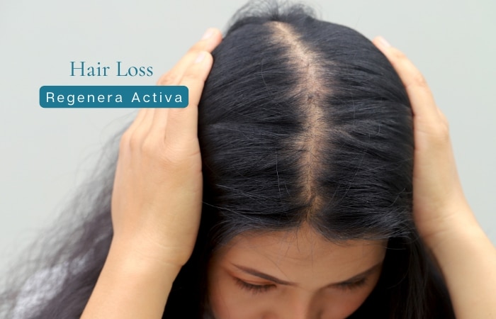 hair loss treatment