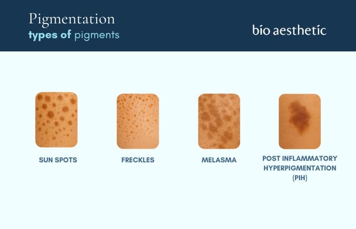 TYPES OF PIGMENTATION