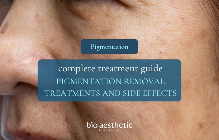 pigmentation removal singapore