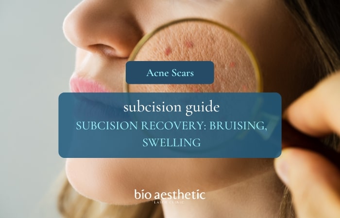 subcision downtime recovery