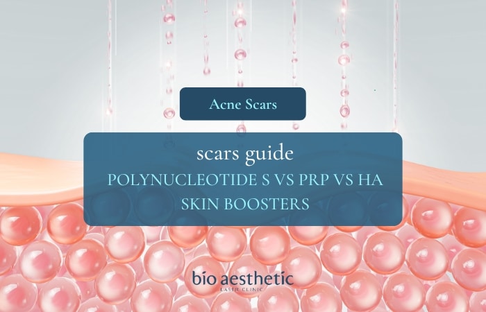 Rejuran S vs PRP vs HA Skin Boosters