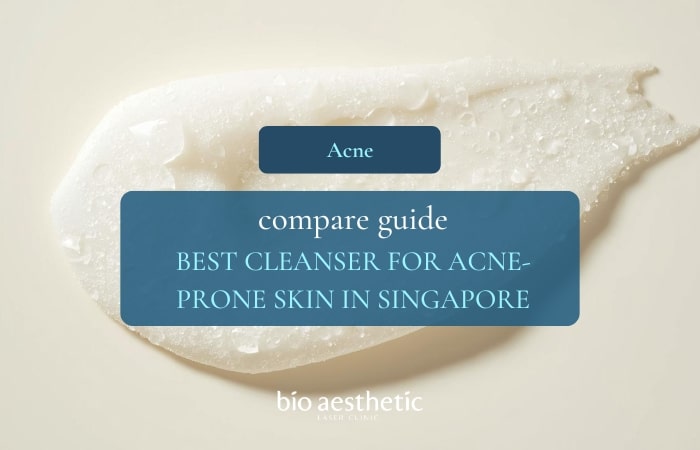 Best Cleanser for Acne-Prone Skin in Singapore Humidity
