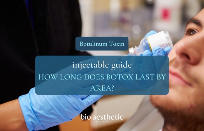 how long does botox last by area
