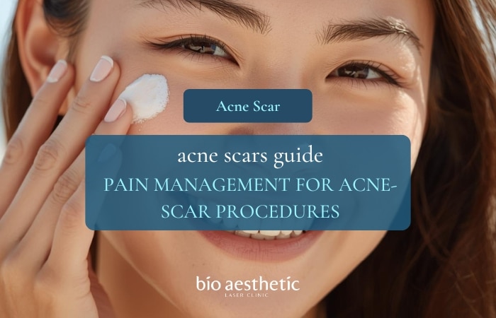 sunscreen for acne prone skin singapore