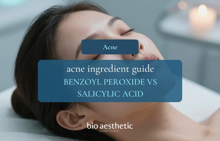 Benzoyl Peroxide vs Salicylic Acid — Which Should You Start With?