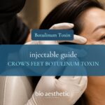 Crow’s Feet: What Improves, What Does Not, and Alternative Options Bio Aesthetic Laser Clinic article thumbnail